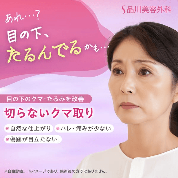 태국 현지화 SNS 콘텐츠 예시 3